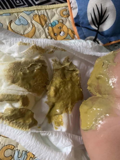 Hơi nhạy cảm chút 🌝🌝