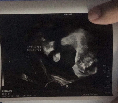 ช่วยดูเพศน้องหน่อยค่ะ