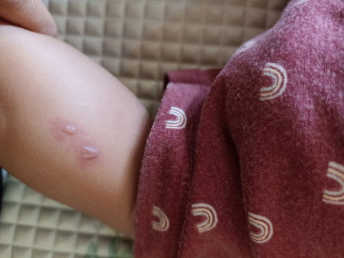 Kaki Tiba Tiba Ada luka