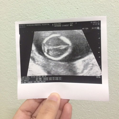 อยากทราบขนาดของน้องค่ะ