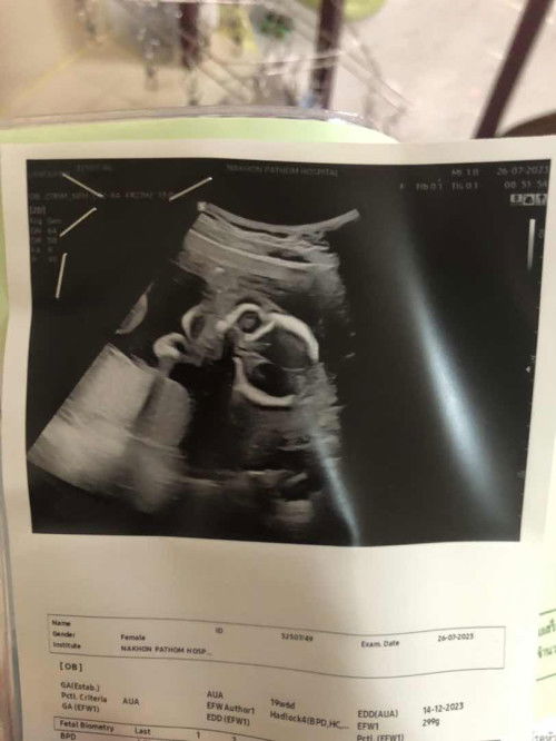 อยากถามเเม่ๆที่ดูเป็นหน่อยค่ะ