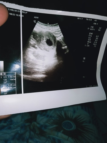 Ada yg sama kah.hpht 11mei.harus nya 12w tadi pas USG 6w5d .USG karena ada flek..