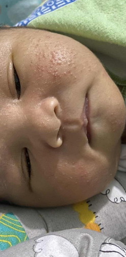 Bun klw seperti ini bahaya ga ya untuk bayi? Dn untuk menghilangkan nya sebaiknya pakai apa bun?