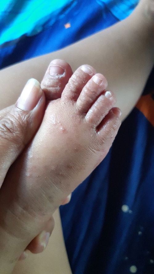 Ada yg pernah ngalamin?