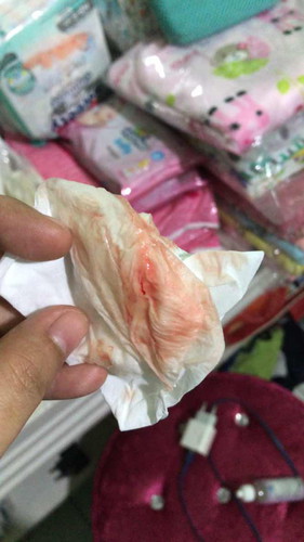 bun apakah ini tanda mau melahirkan?