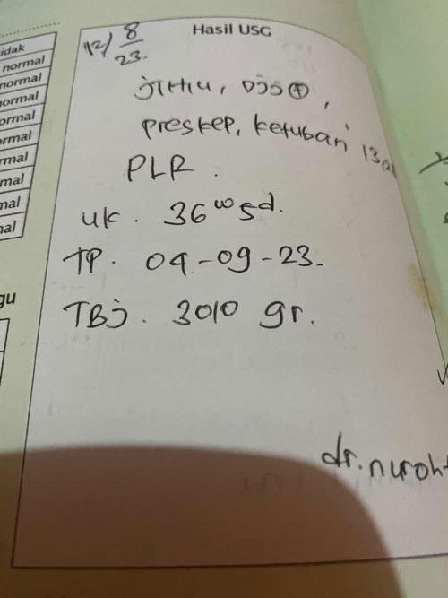 Bb janin usia 36 minggu