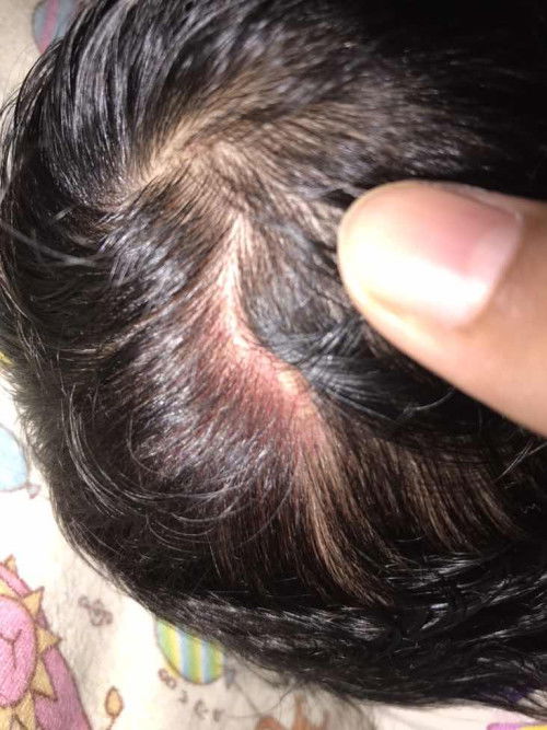 Kepala belakang merah