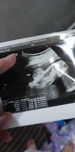 31w4วันน้ำหนักลูก1459 ถือว่าตามเกณฑไหม ใครทราบบอกทีนะค่ะ