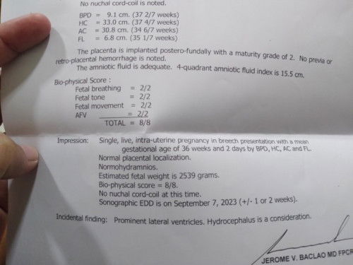 Findings:prominet lateral ventricles.hydrocephalus is a consideration