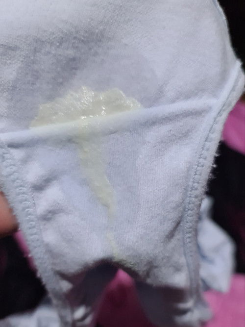 Normal po kaya itong vaginal discharge k po. I am 28 weeks na po. Thank you!