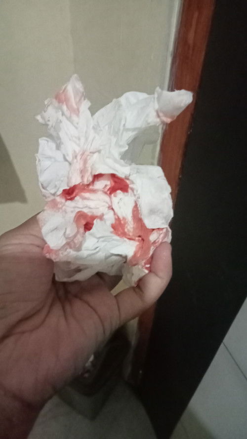 Keluar darah usia kehamilan 39mingg