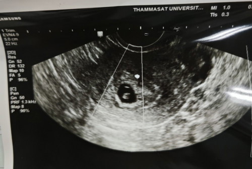 8 วีค+ยังไม่เจอหัวใจ