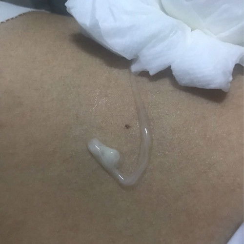 สอบถามคะ 37w+1 กำหนดคลอด2 ก.ย. ค่าา🥳