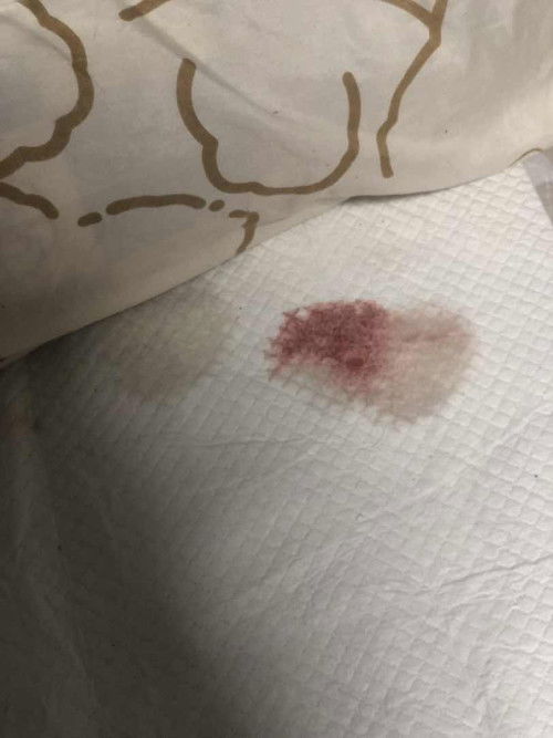 กว่าปากมดลูกจะเปิดครบ10ซม.ใช่เวลานานไหม