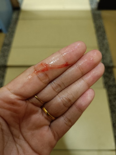 Normal ke tak?
