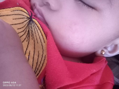 Bintik merah di pipi