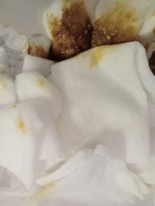 คลอดน้องหมาได้6วันแล้วน้องถ่ายแบบนี้สีนี้ปกติไหมคะ  #ขอบคุณล่วงหน้าคะ #ท้องแรกคะ