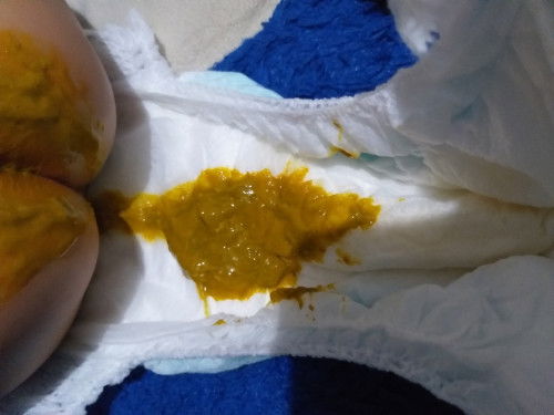 Seputar pup bayi, maaf jika jijik🙏