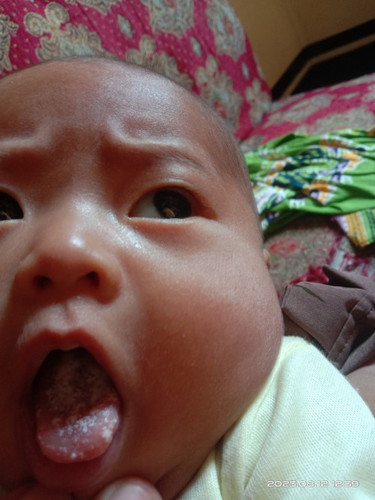 Gom pada bayi