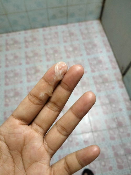 มูกหรือตกขาวค่ะ #ท้องเเรก