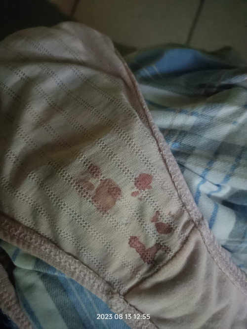 Spotting at 35 weeks and 4 days