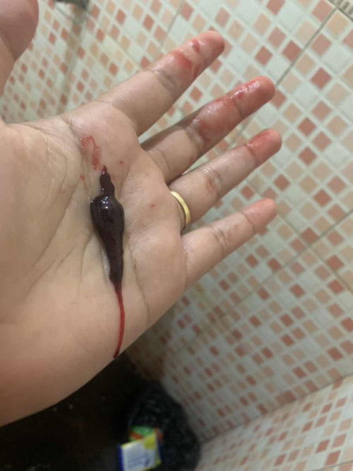 Bantu jawab ya bund, maaf kalo jorok.