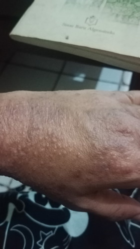 Bun aku udah tm 2 gatel2 bgni kira2 obatnya apa ya bun