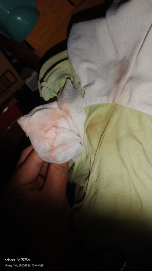 MUCUS PLUG NABA TO??