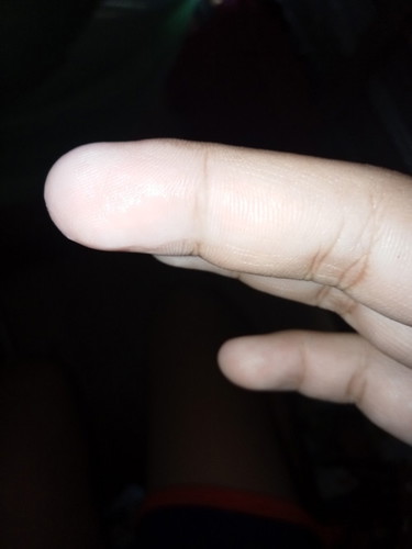 มีน้ำขุ่นๆไหลออกมา