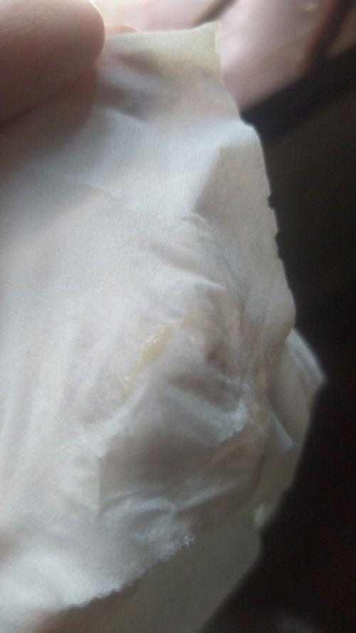 Maaf kalau jorok.ini keputihan apa tidak ya.lagi hamil 7 week soalnya