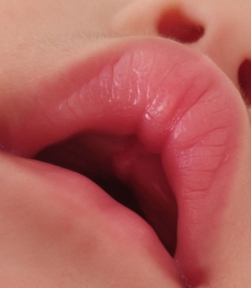 Is it normal ? Or lip tie?