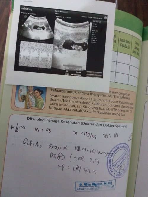 Kehamilan ke-2 setelah USG free dari Puskesmas