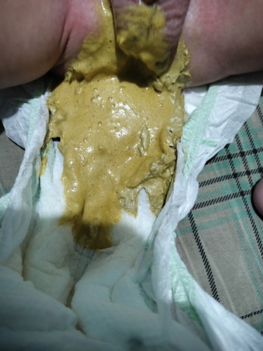 Bakit subra iyak ni LO pag tumatae?