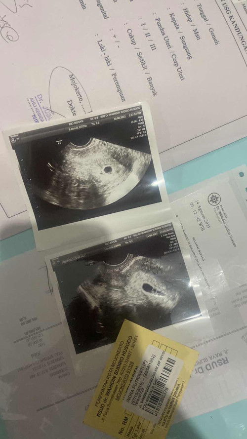 Moms ini normal apa tidak bentuknya gini?