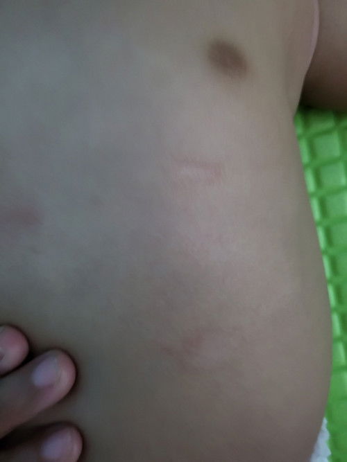 Kulit bermasalah , apakah ada yang seperti ini bunda