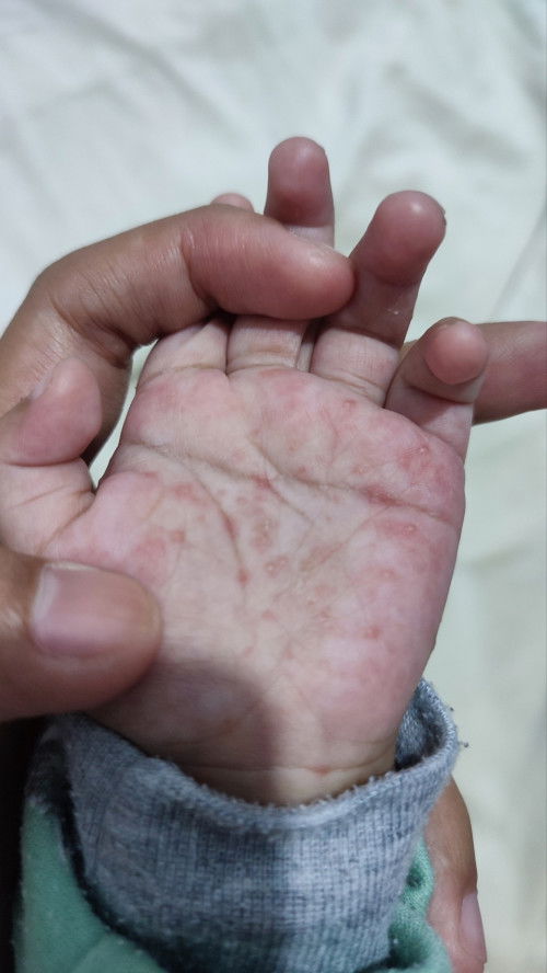 Merah melenting ditelapak tangan