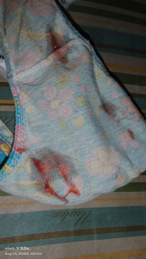 Tuloy tuloy na bloody show