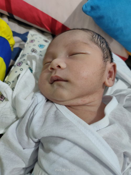 Hello po, New mom here, ano po kaya itong natubo sa leeg at pisngi ng 9 days old baby ko? Salamat.