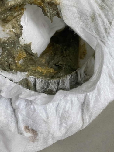 สอบถามอุจาระน้องวัย1เดือน20 วันค่ะ น้องมีอุจาระสีเหลืองป่นเขียว ผิดปกติมั้ยค่ะ