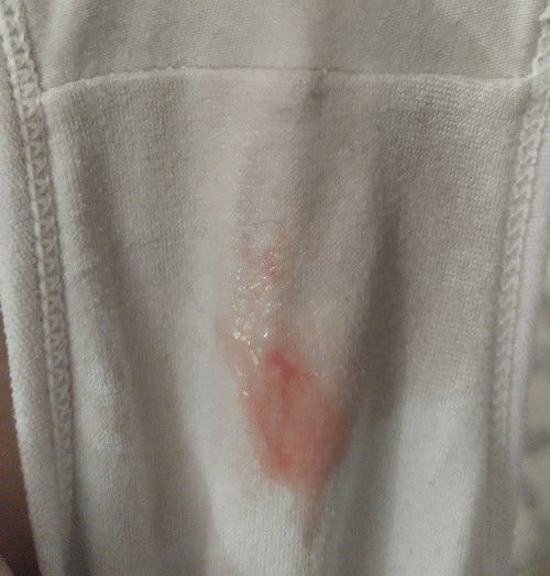 Hamil usia 38 Minggu 1 hari