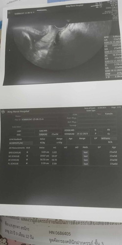 แม่คะน้องเพศอะไร