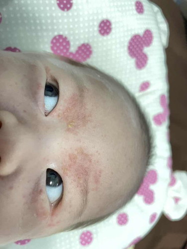 สอบถามเเม่ๆค่ะ