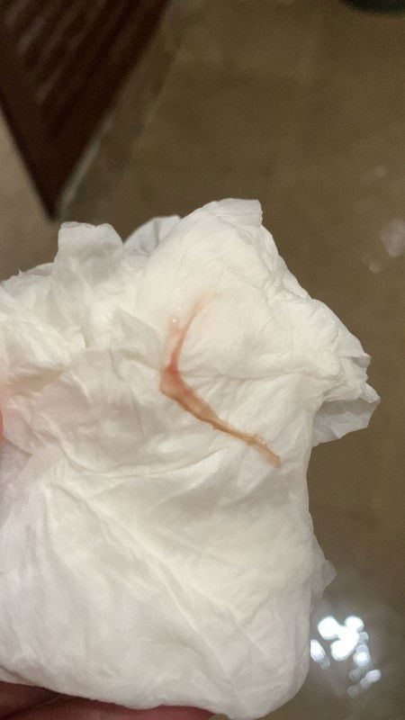 Flek usia 6w4d apakah normal?