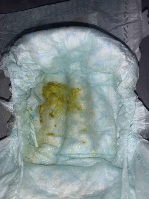 Bab hijau bayi 3 bukan 20 hari