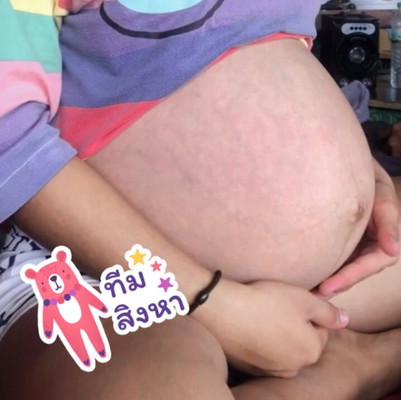 ท้อง37w6d ท้องแรกค่ะ