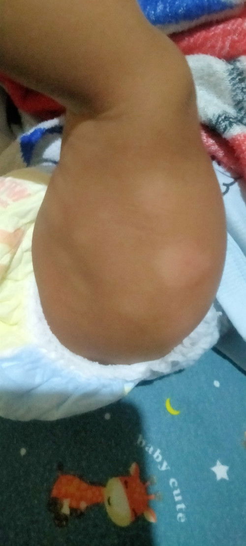 Sharing bund barang kali ada yg punya pengalam sama