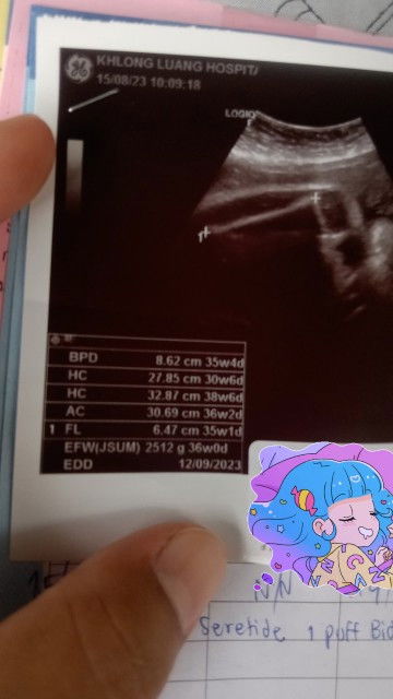 🤰รบกวนสอบถามแม่ๆหน่อยค่ะ🤰