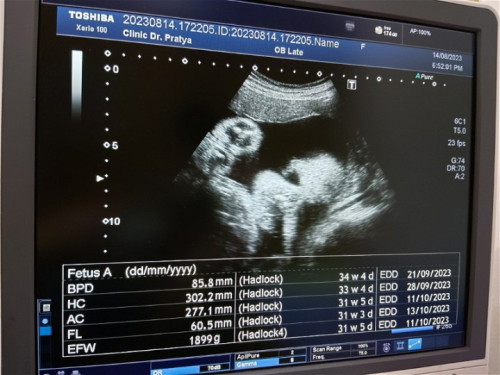 รอบศีรษะใหญ่ก่วาเกณ