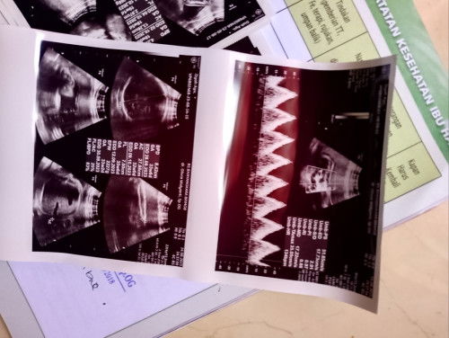 32 week seperti 35 week