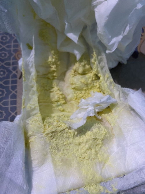 Normal gak pup warna kaya gini